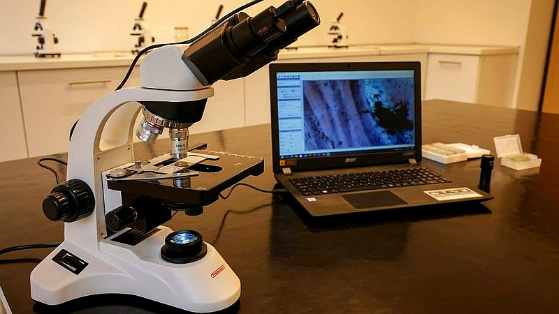 Y chromosome loss - health article image 2