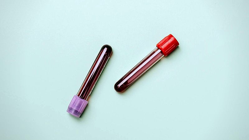 HIV in Ghana - health article image 3