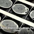 chronic pain and depression - health article image 1