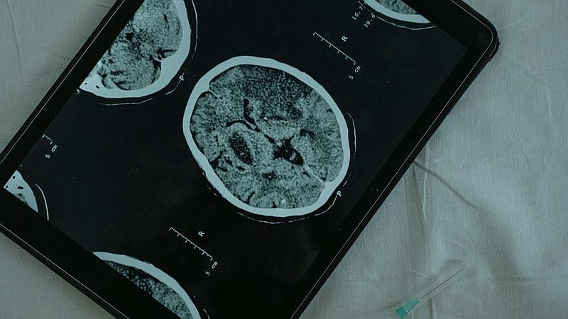 chronic pain and depression - health article image 2