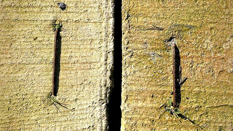 nose picking and alzheimer's - health article image 2