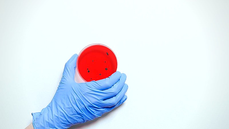 Taco Bell Cyclospora false positive - finance article image 2