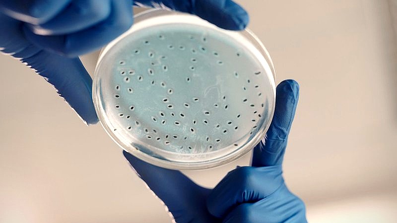 Taco Bell Cyclospora false positive - finance article image 3
