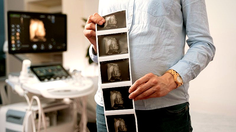 pioneering treatment twins - health article image 3