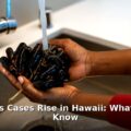 cyclosporiasis Hawaii - health article image 1