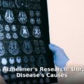 Columbia Alzheimer's research - health article image 1