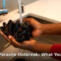 San Francisco parasite outbreak - health article image 1