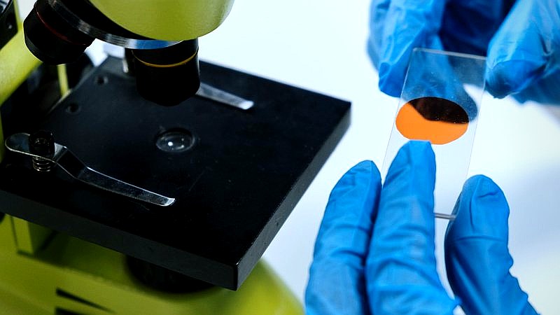 Novartis autoimmune cell therapy - finance article image 2